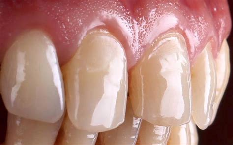 Simple Science: How to Make a Volcano with Kids