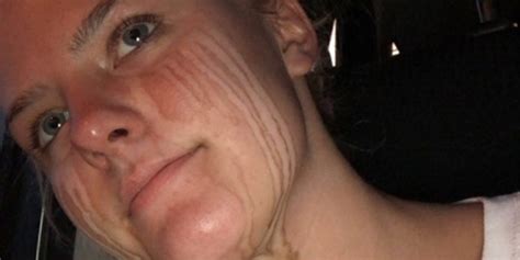 Teens Post Spray Tan Selfie Goes Viral Fox News