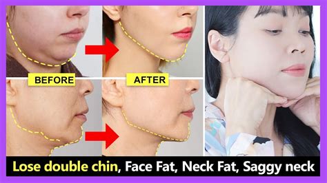 Easy Face Exercise Double Chin Removal Face Fat Neck Fat Saggy