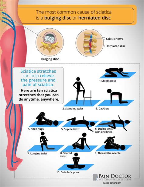 Infographic Sciatica Stretches Sciatica Stretches Sciatica Pain Relief Sciatic Pain Sciatic