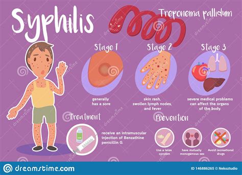 Infographic Of Syphilis Stock Vector Illustration Of Injection 146886265
