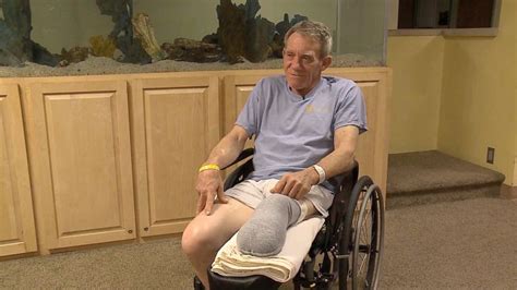 Nebraska Farmer Recounts Sawing Off His Leg With A Pocket Knife To Save His Own Life Abc News