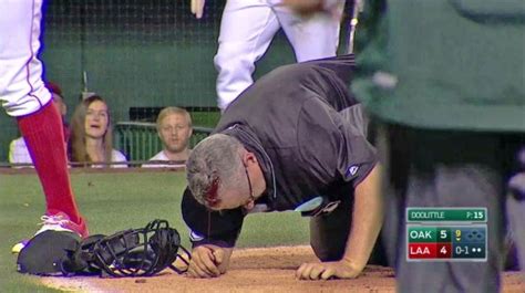 video umpire hit in head with errant bat leaves game orange county register