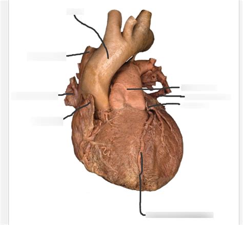 Superficial Heart Structures Diagram Quizlet