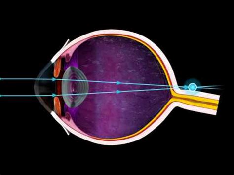 Short Sighted and Long Sighted - 3D Medical Animation of the Eye || ABP © - YouTube