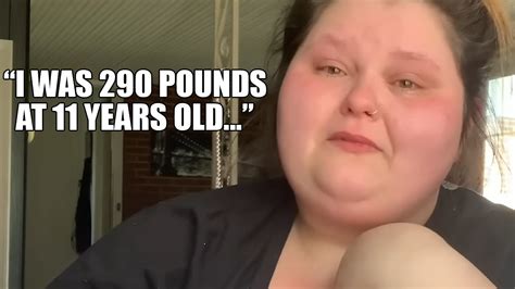 Weight Loss Youtuber Nearly Doubles In Size And Becomes Morbidly