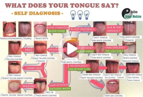 Pin On Edvaldojuniorss Tongue Health Health Chart Acupuncture Benefits