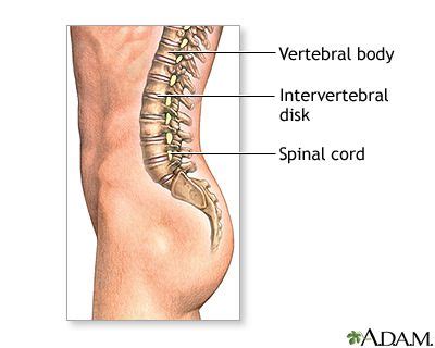 Spinal Fusion Seriesnormal Anatomy Medlineplus Medical Encyclopedia My XXX Hot Girl