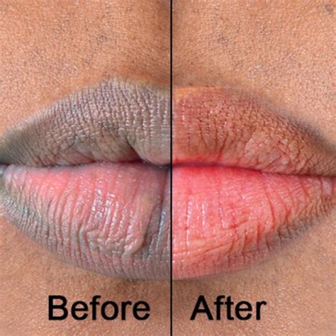 Lighten Dark Lips Smokers Lips Guide · Shop The Glow Sa