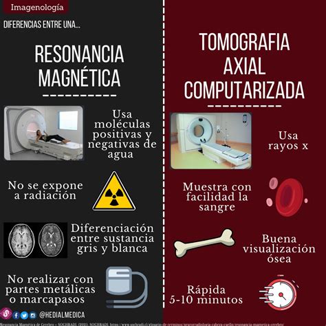 Diferencias Entre Tomograf A Computarizada Y Resonancia Magn Tica My