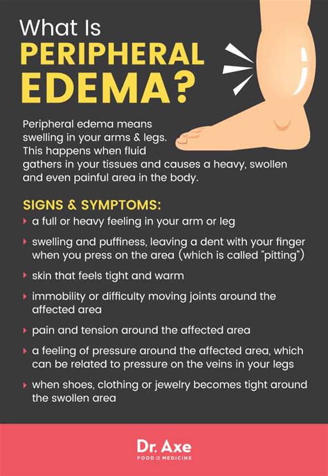 Peripheral Edema 7 Natural Treatments To Reduce Swelling