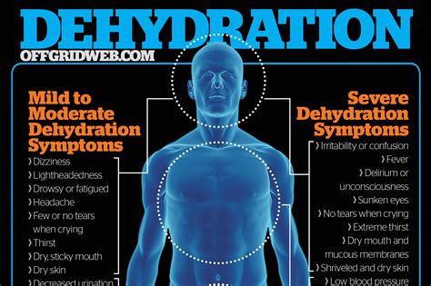 Signs Of Dehydration In Adults