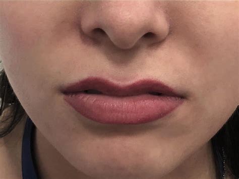 How To Do Thin Lips