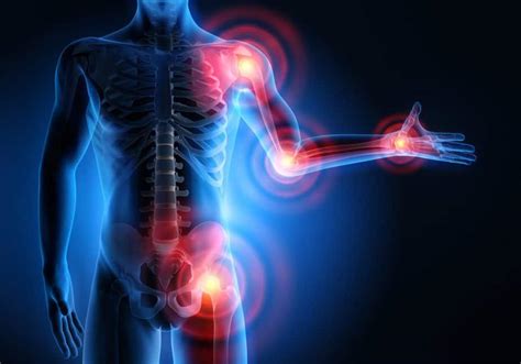 Muscle Inflammation How To Recognize Prevent And Successfully Cure It