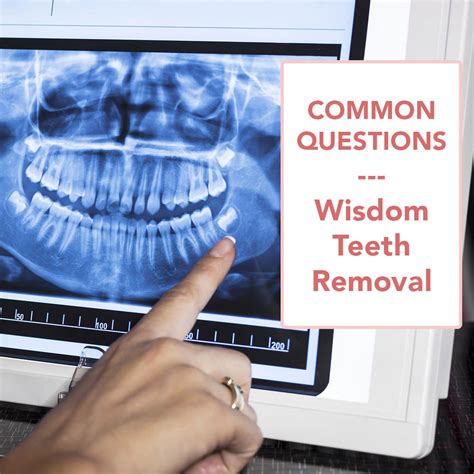 Common Questions About Wisdom Tooth Extraction Dentistry On King
