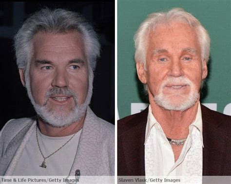 Kenny Rogers Before And After Plastic Surgery Famousfaceshub