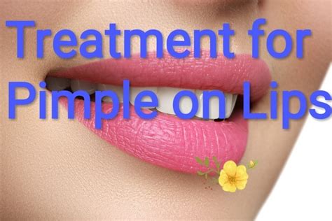 How To Get Rid Of Pimples On Your Lip Line Fast Mang Temon