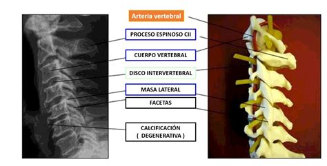 Anatomía De La Columna Cervical Dolopedia
