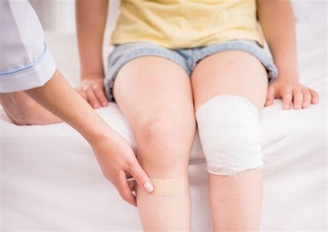 Kaki berbentuk ( o ) atau genu varum dan kaki berbentuk ( x ) atau genul valgum merupakan salah satu kelainan pada kaki, biasanya kaki konsultasi ke dokter pun tidak hanya kepada 1 dokter saja, banyak rumah sakit besar di jakarta sudah ia datangi untuk berkonsultasi dengan dokter tulang. Rakitis - Gejala, penyebab dan mengobati - Alodokter