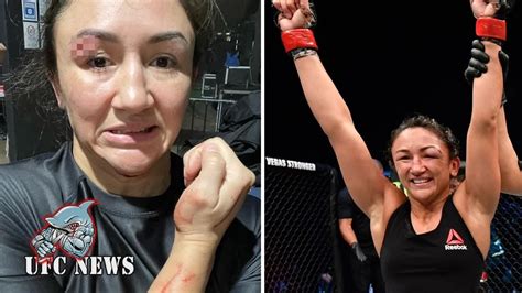 UFC Star Carla Esparza Suffers Horror Eye Gash That Sees Her Fury Pro