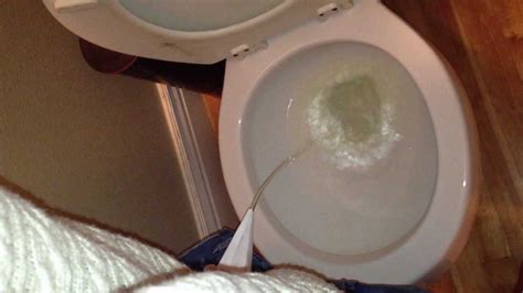 The Pee Pocket Used In A Public Bathroom With Mold In The Toilet Youtube