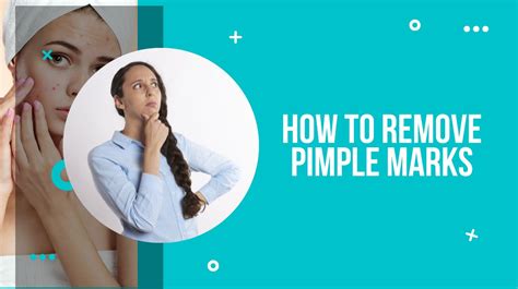How To Remove Pimple Marks Drug Research