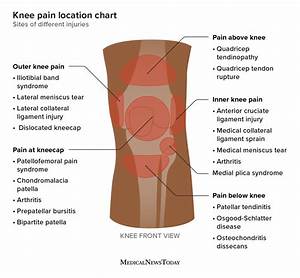 Knee Location Chart Sites Of Different Injuries