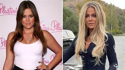 khloe kardashian s plastic surgery transformation from then to now