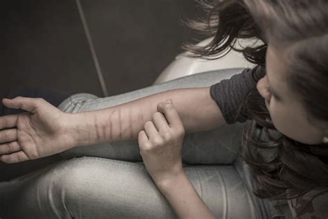 The Signs And Symptoms Of Self Harm And Where To Get Help Blog