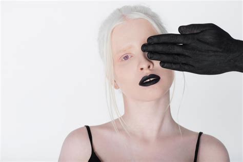 Can Albino People Dye Their Hair Quick Diy And 7 Quick Tips Beezzly