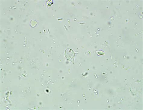 Giardia Cyst In Fecal Float