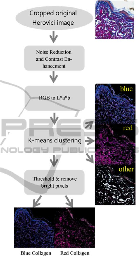 Figure 1 From Automated Analysis Of Collagen Histology In Ageing Skin Semantic Scholar