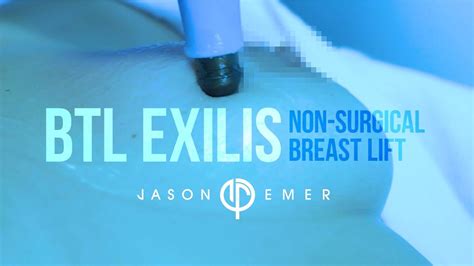 Non Surgical Breast Lift Laser Breast Lift Btl Exilis Radiofrequency Skin Tightening Youtube