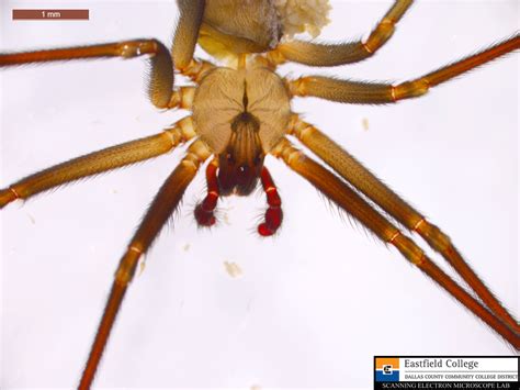 Scanning Electron Microscope Blog Face To Face With A Brown Recluse