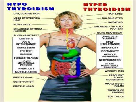 Pin On Thyroid Disease Home Remedies And Treatment