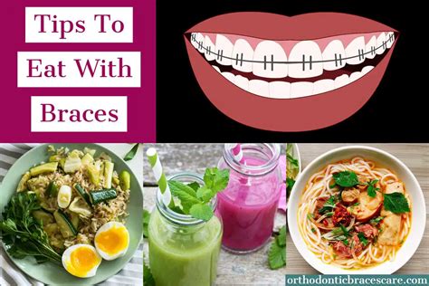 Can You Eat Cereal With Braces Kitchen Foodies