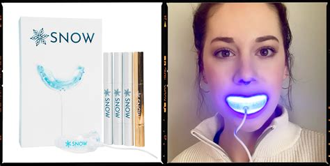 Snow Teeth Whitening Review 2022 My Results Photos And Safety