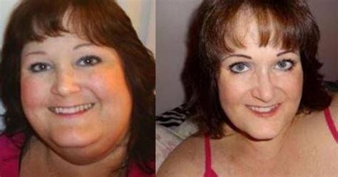 how to drop 230 pounds — without weight loss surgery lifestyles