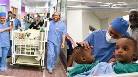 Conjoined Nigerian Twins Successfully Separated After 14 Hour Surgery