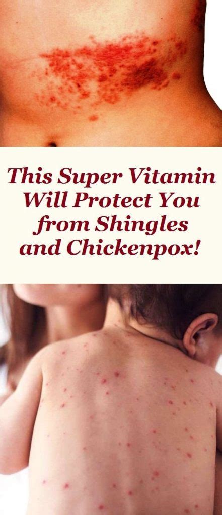 Although vitamin c and zinc are both important for your health, you shouldn't consume these nutrients in excess. THIS SUPER VITAMIN WILL PROTECT YOU FROM SHINGLES AND ...