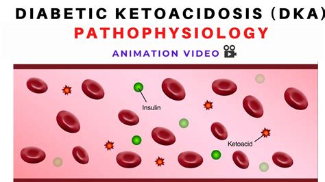Pathophysiology Of Diabetic Ketoacidosis DKA Animation Diabetes