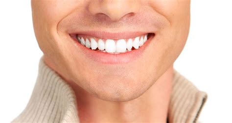 How white you would like your teeth to be. #dewittdentalassociates #teeth #dental #smile | Smiles ...