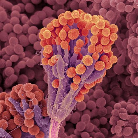 Fungos Filamentosos Biofábricas Em Biotecnologia Profissão Biotec