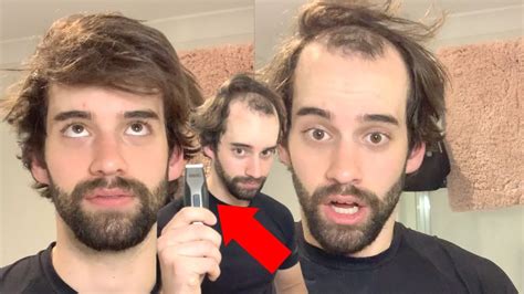 Balding Man Shaves Head Bald In Incredible Transformation Youtube