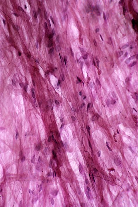 Areolar Connective Tissue Lm Photograph By Science Stock Photography