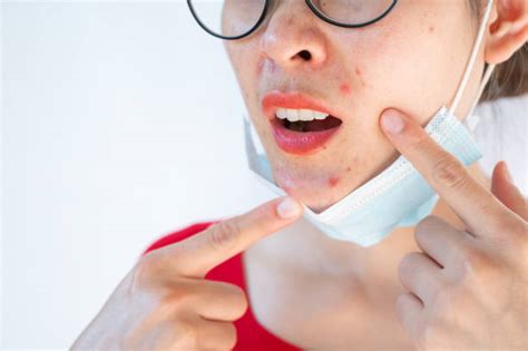 Face Mask Rash Stock Photos Pictures And Royalty Free Images Istock