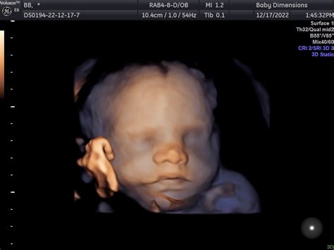 Why It Is Important To Have An Ultrasound Tech Scan Your Baby Who Is Ob