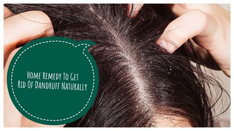 Home Remedy To Get Rid Of Dandruff Naturally Dandruff Treatment Remove Dandruff Completely