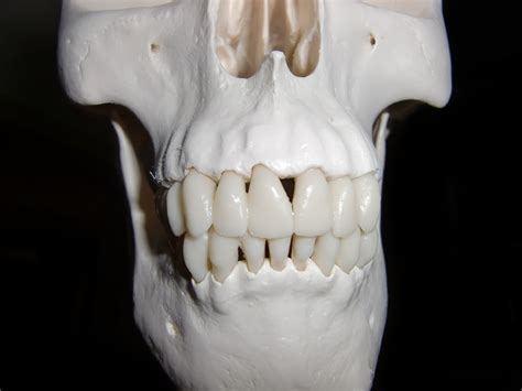 Free Images Hand White Mammal Death Dentist Human Body Head
