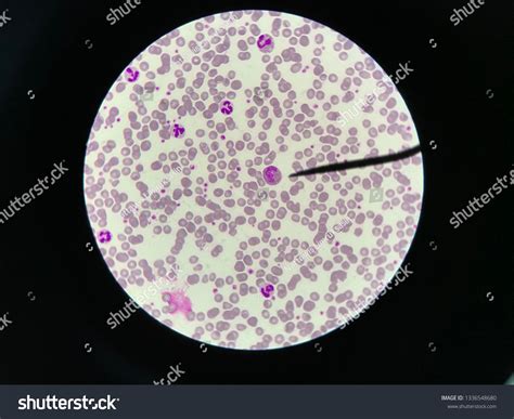 Zdjęcie Stockowe „eosinophil Cat Blood Smear Under Microscope